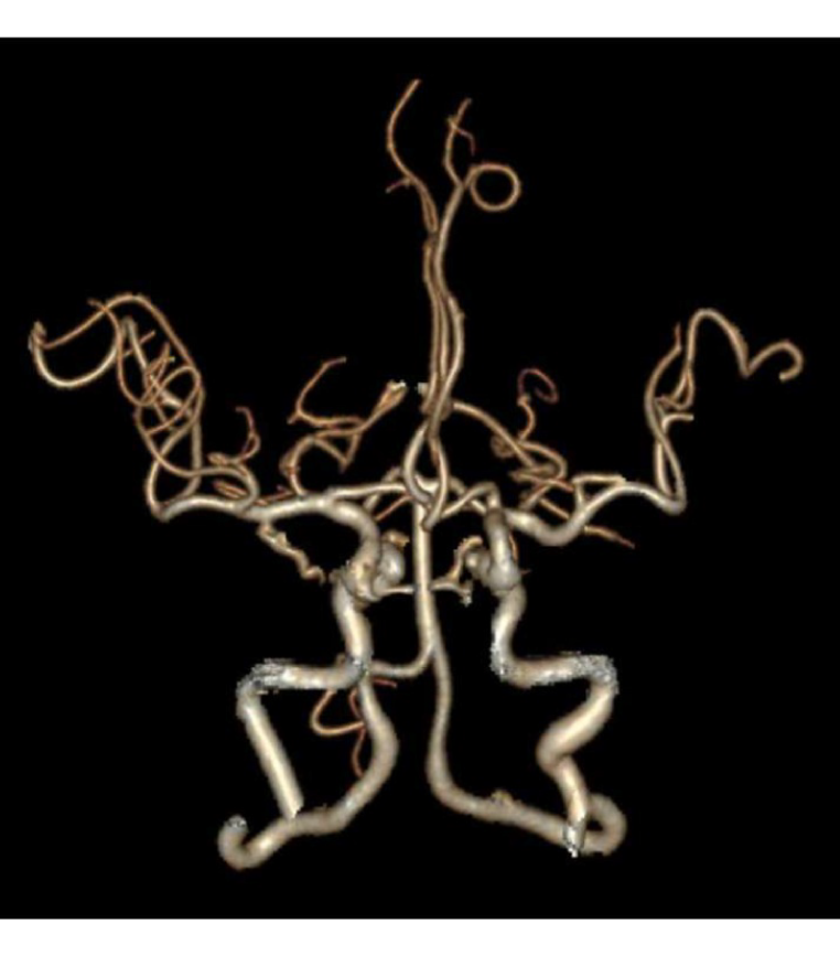 脳ドックイメージ1