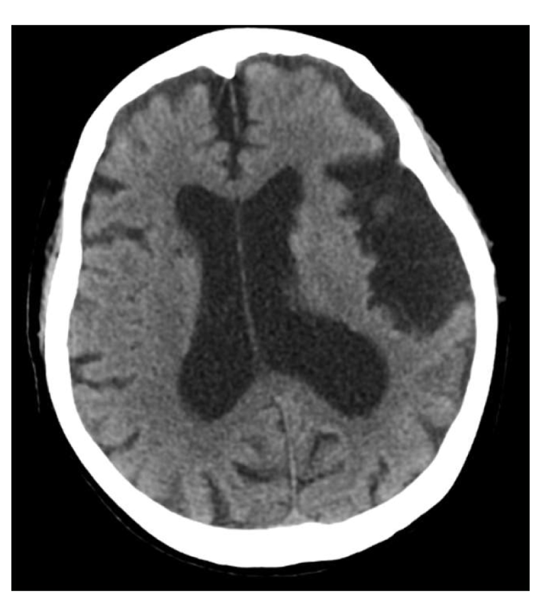 脳ドックイメージ2