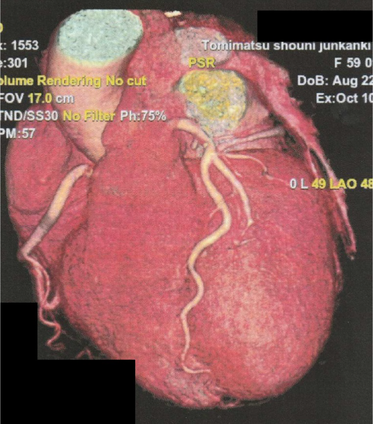 心臓ドックイメージ1