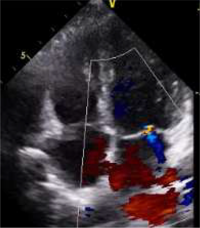 心臓ドックイメージ2